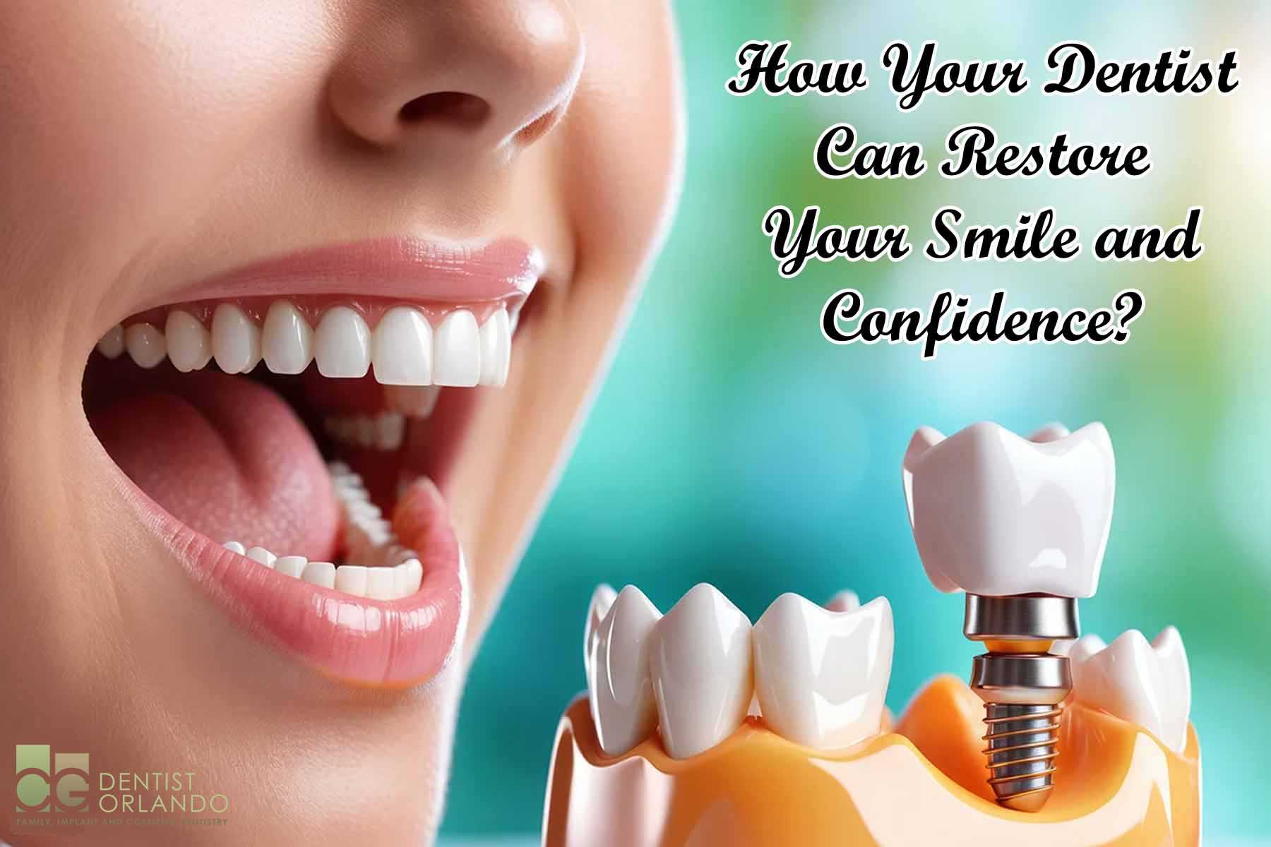 dental implants near me
