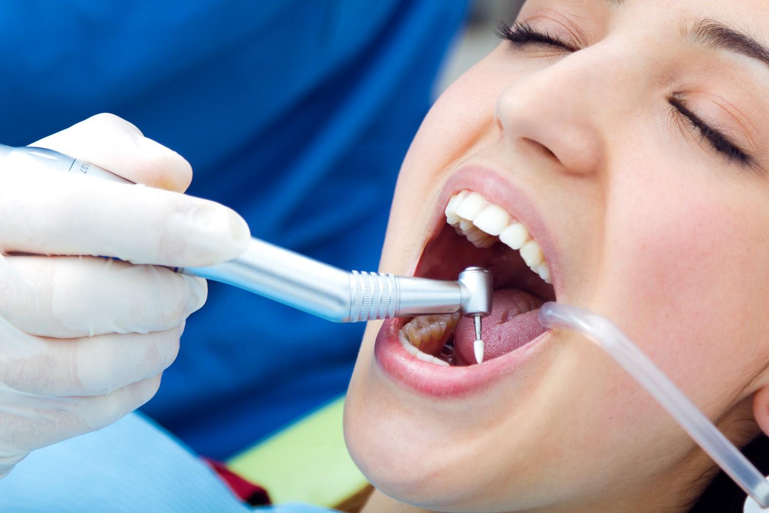 Dental Fillings: A Fast Way to Save a Damaged Tooth